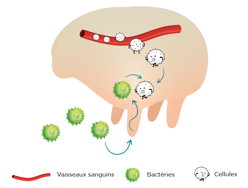 Schéma mammite clinique subclinique CTH AGRI